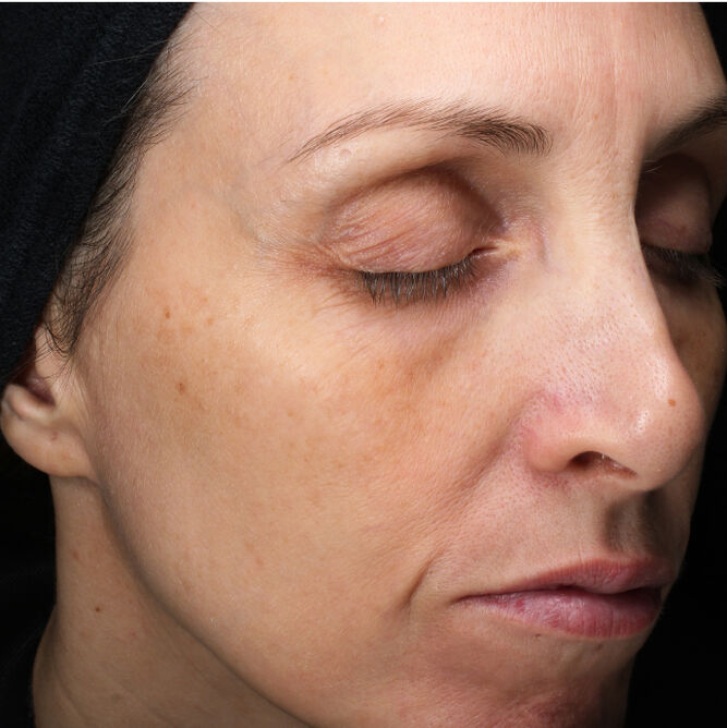 Total Protective Cream SPF 30, 