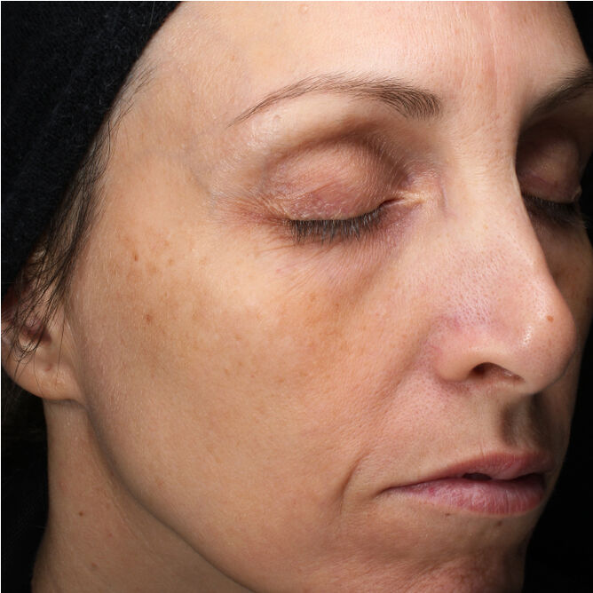 Total Protective Cream SPF 30, 