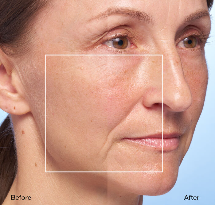 Micro-Click Concentrate, 